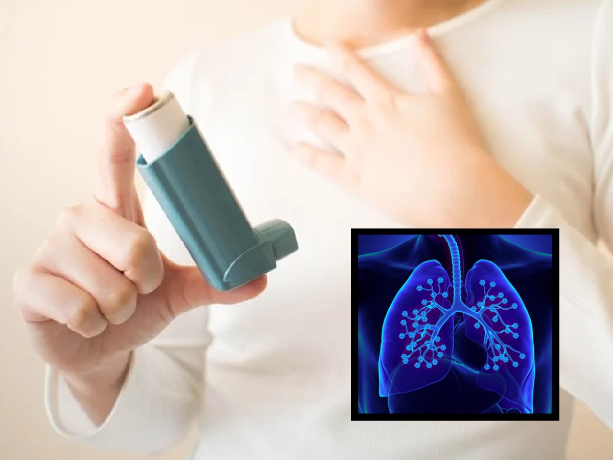 World Asthma Day: वायू प्रदूषणामुळे वाढतोय दम्याच्या रूग्णांचा त्रास; कशी घ्याल काळजी? title=