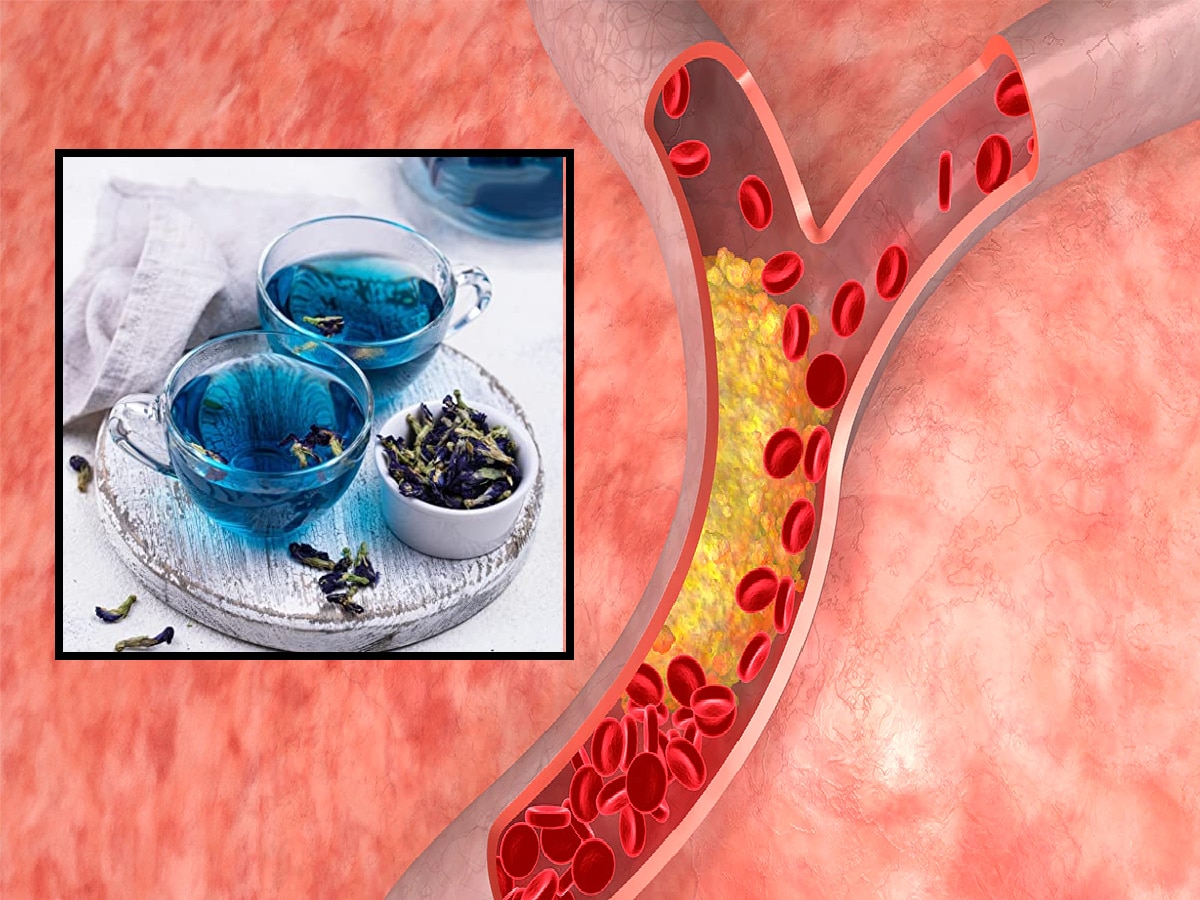 LDL cholesterol Reducing Tips : हा ब्लू चहा नसांमध्ये साचलेली घाण काढण्यास करेल मदत, एलडीएल कोलेस्ट्रॉलवर नैसर्गिक आणि घरगुती उपाय title=