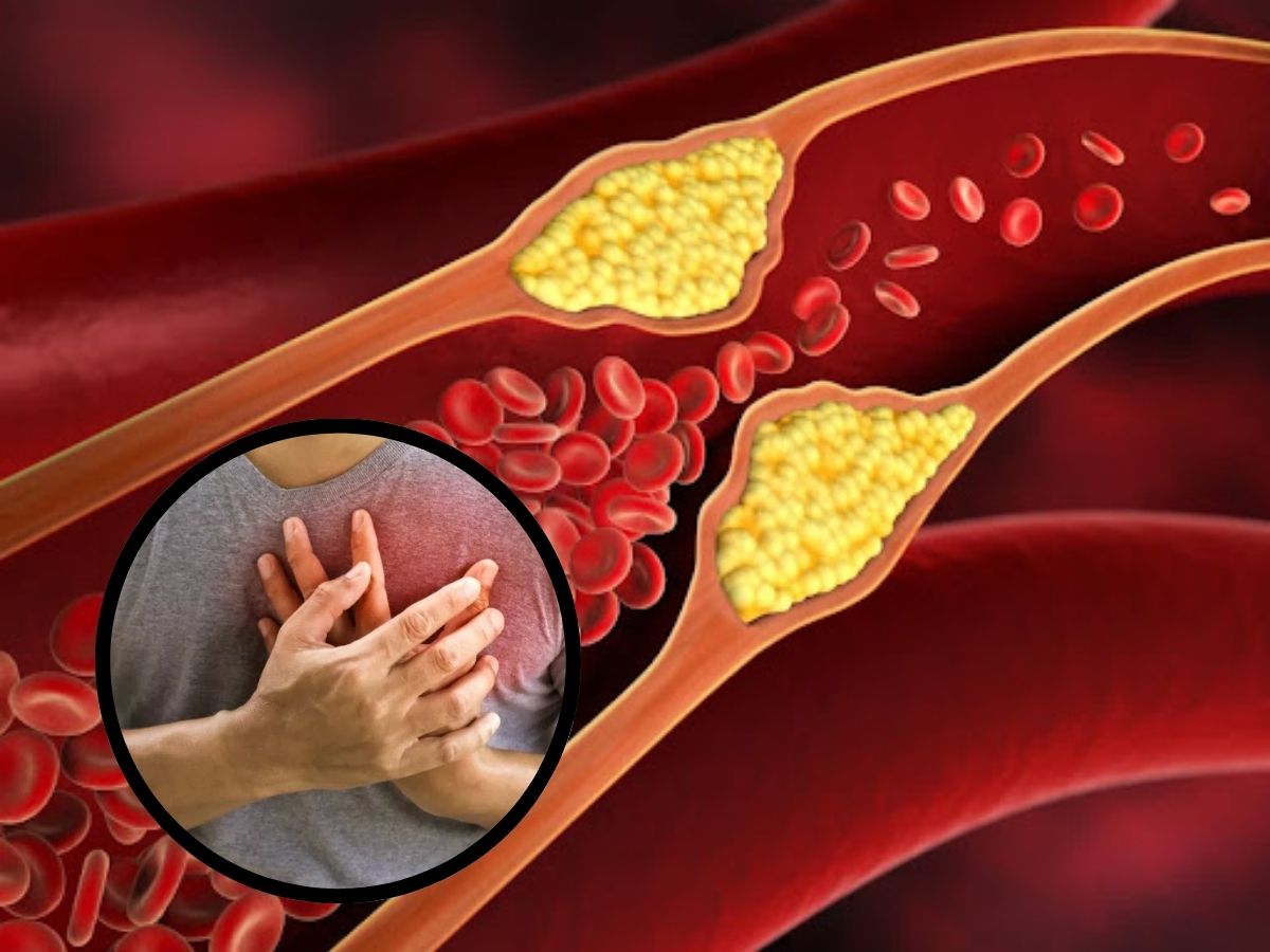 रक्तातील कोलेस्ट्रॉल खेचून काढतील पाच उपाय, निरोगी आरोग्यासाठी हे कराच 