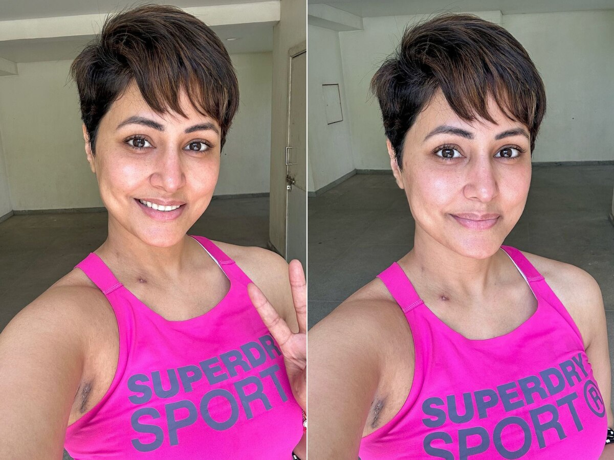 'चेहऱ्यावर निशाण नाही, डोळ्यात मात्र आशा'; पहिल्या किमोथेरेपीनंतर Hina Khan ची पोस्ट  title=