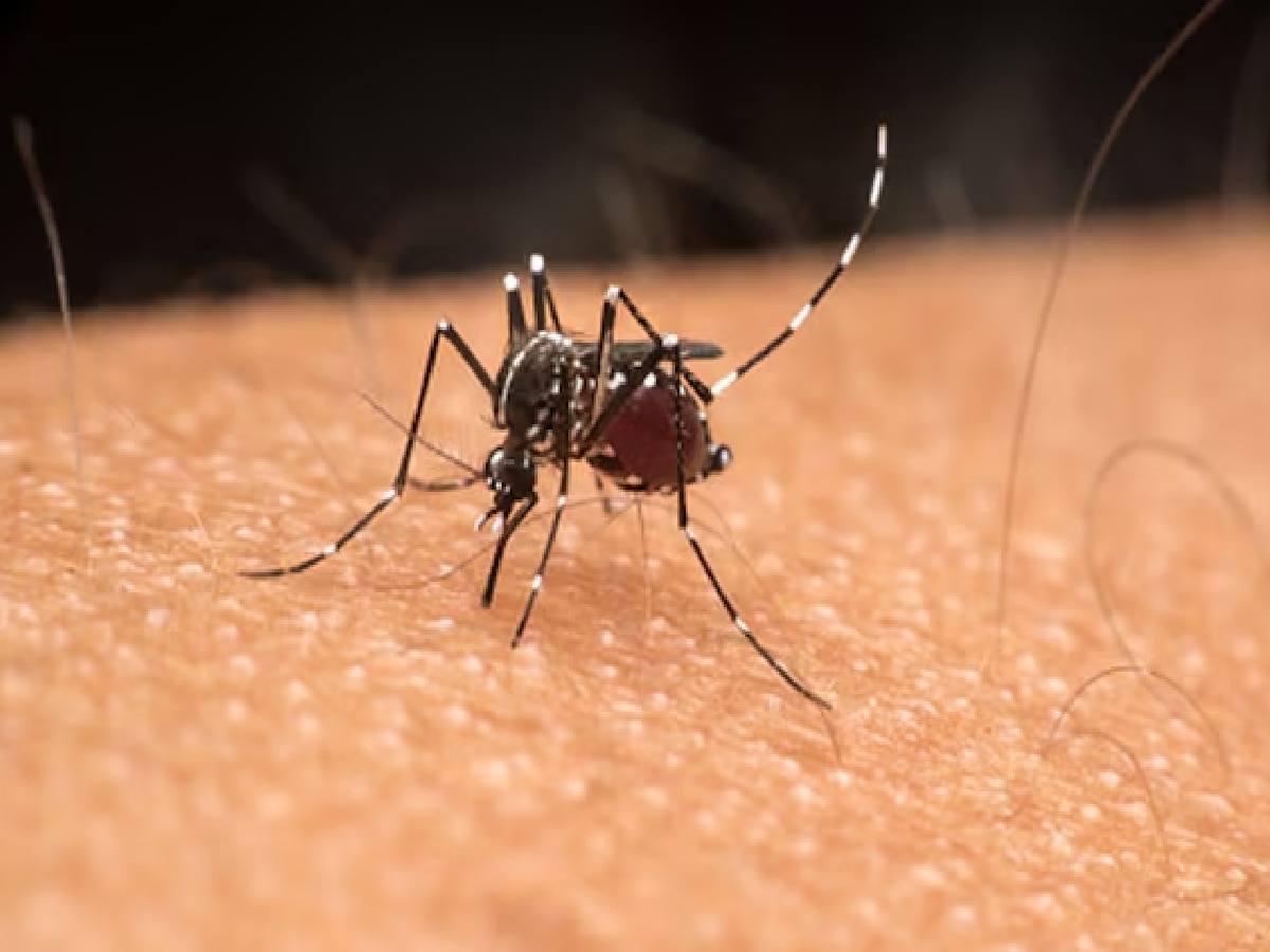 Dengue Fever: डेंग्यूच्या तापात शरीराला सतत खाज का सुटते? जाणून घ्या कारण title=