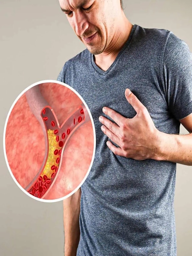 शरीरातील 'या' भागात वेदना म्हणजे Bad Cholesterol च लक्षण