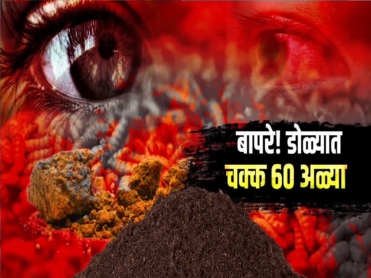 बापरे! महिलेच्या डोळ्यात चक्क 60 जिवंत अळ्या, डॉक्टरही अचंबित... नेमकं काय घडलं? बापरे! महिलेच्या डोळ्यात चक्क 60 जिवंत अळ्या, डॉक्टरही अचंबित... नेमकं काय घडलं?