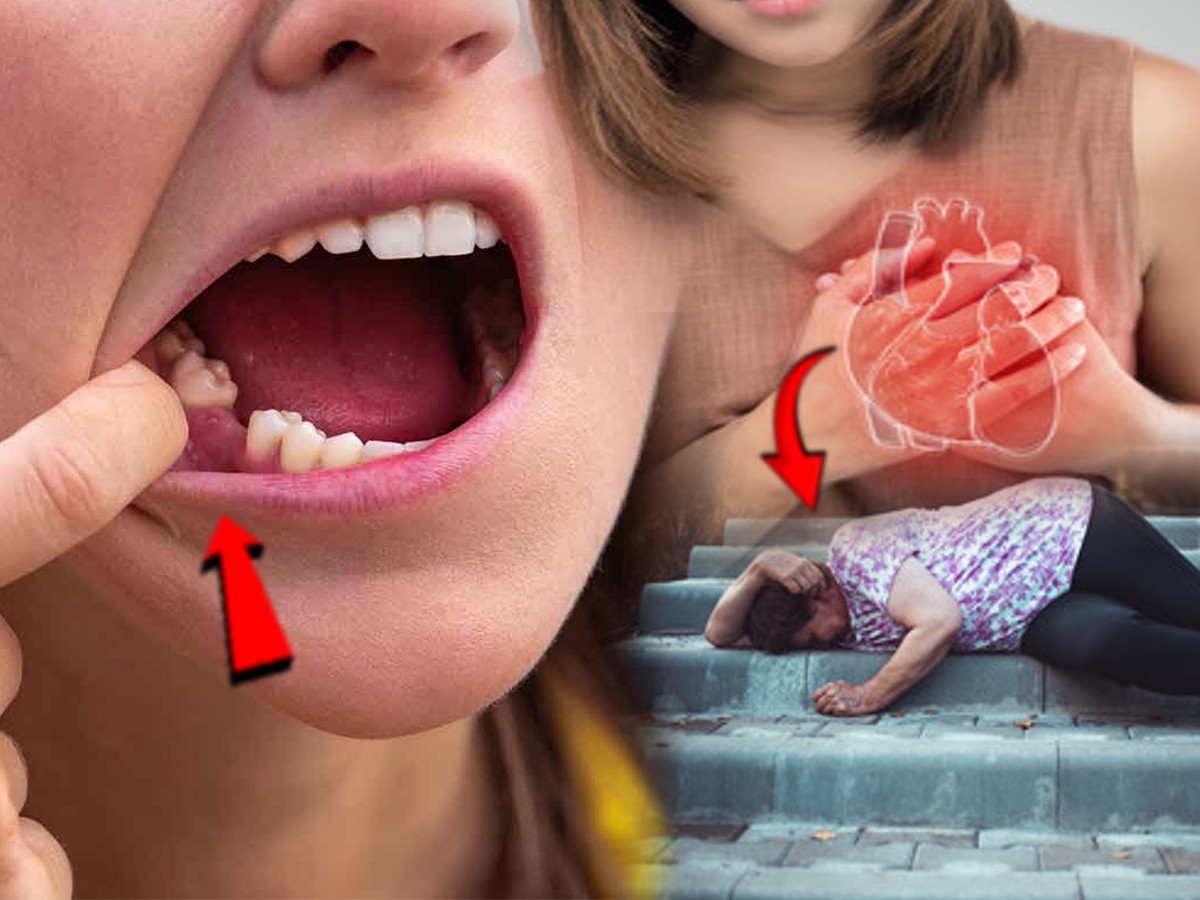 दातांचा अन् Heart Attack चा थेट संबंध! संशोधकांचा दावा; समजून घ्या नेमकं कनेक्शन दातांचा अन् Heart Attack चा थेट संबंध! संशोधकांचा दावा; समजून घ्या नेमकं कनेक्शन