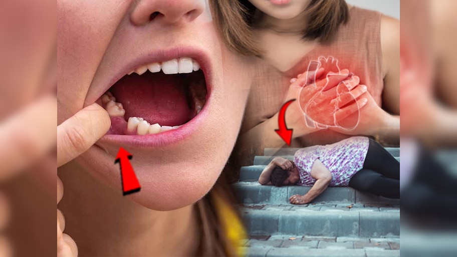 दातांचा अन् Heart Attack चा थेट संबंध! संशोधकांचा दावा; समजून घ्या नेमकं कनेक्शन
