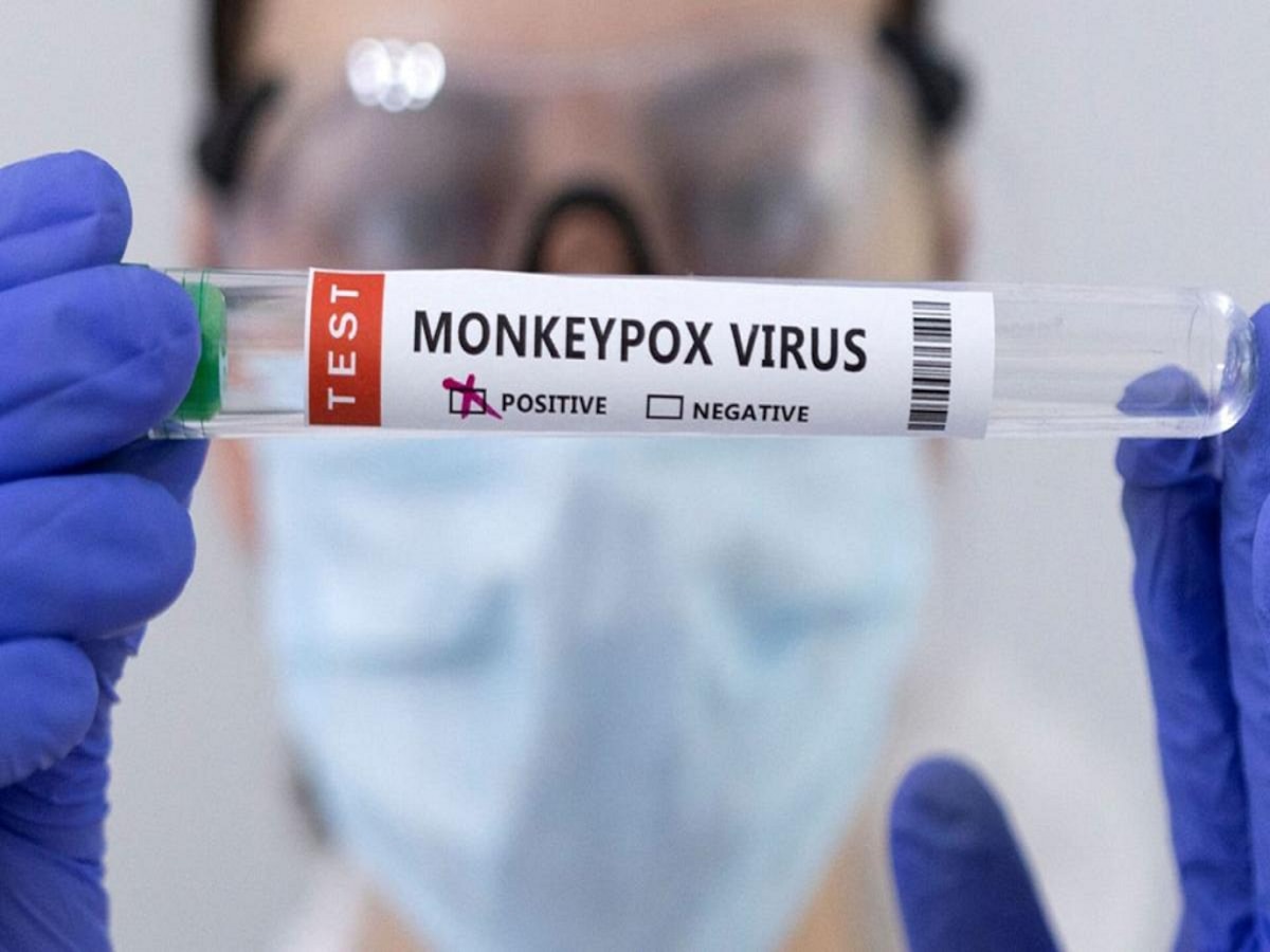 Monkeypox Virus:  मंकीपॉक्सनं वाढवली चिंता; भारतातही नवे नियम लागू, कोरोनाचेच दिवस परततायत?  title=