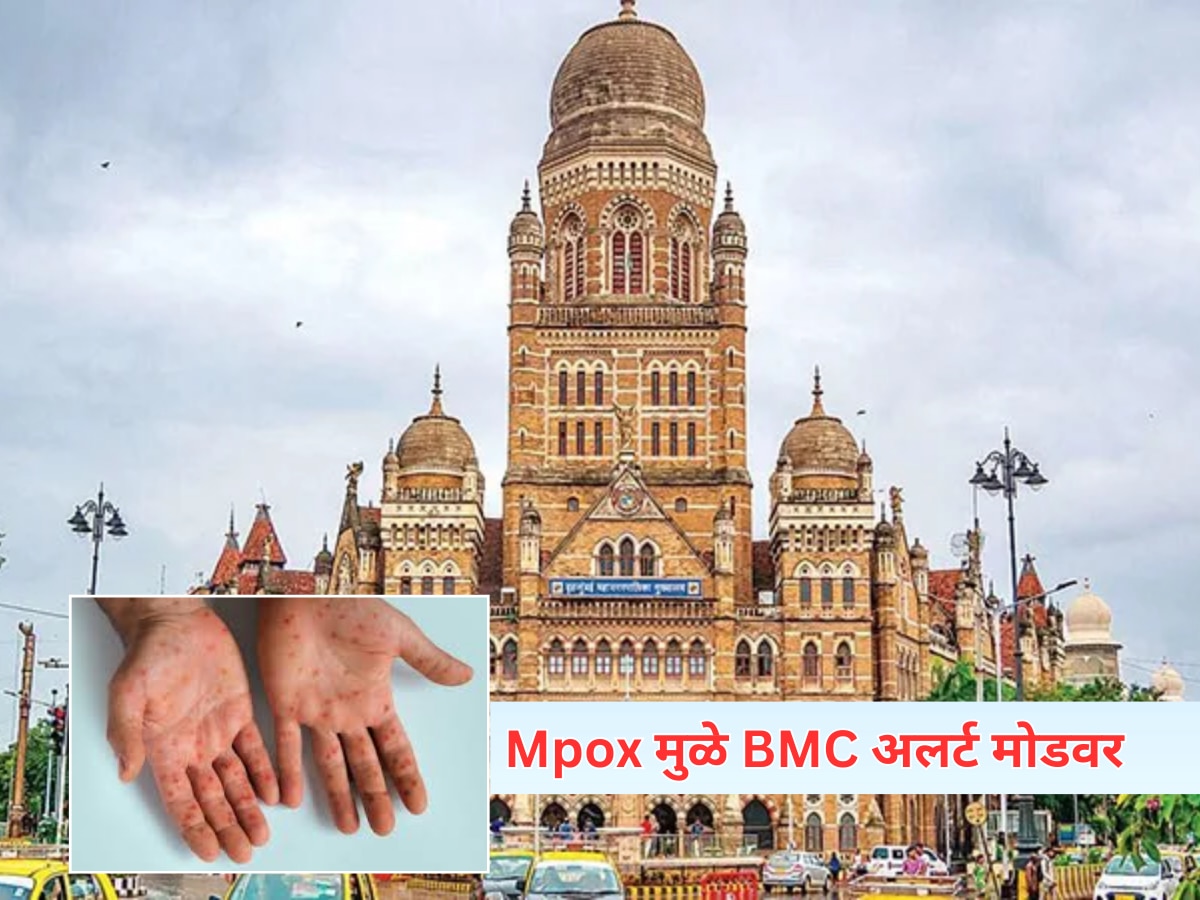 Mpox संसर्गावर मुंबई महापालिका अलर्ट मोडवर  title=