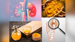 युरिक ऍसिडचा त्रास होतोय? रिकाम्या पोटी प्या पिवळं पाणी, लघवीवाटे निघून जाईल सगळी घाणं 