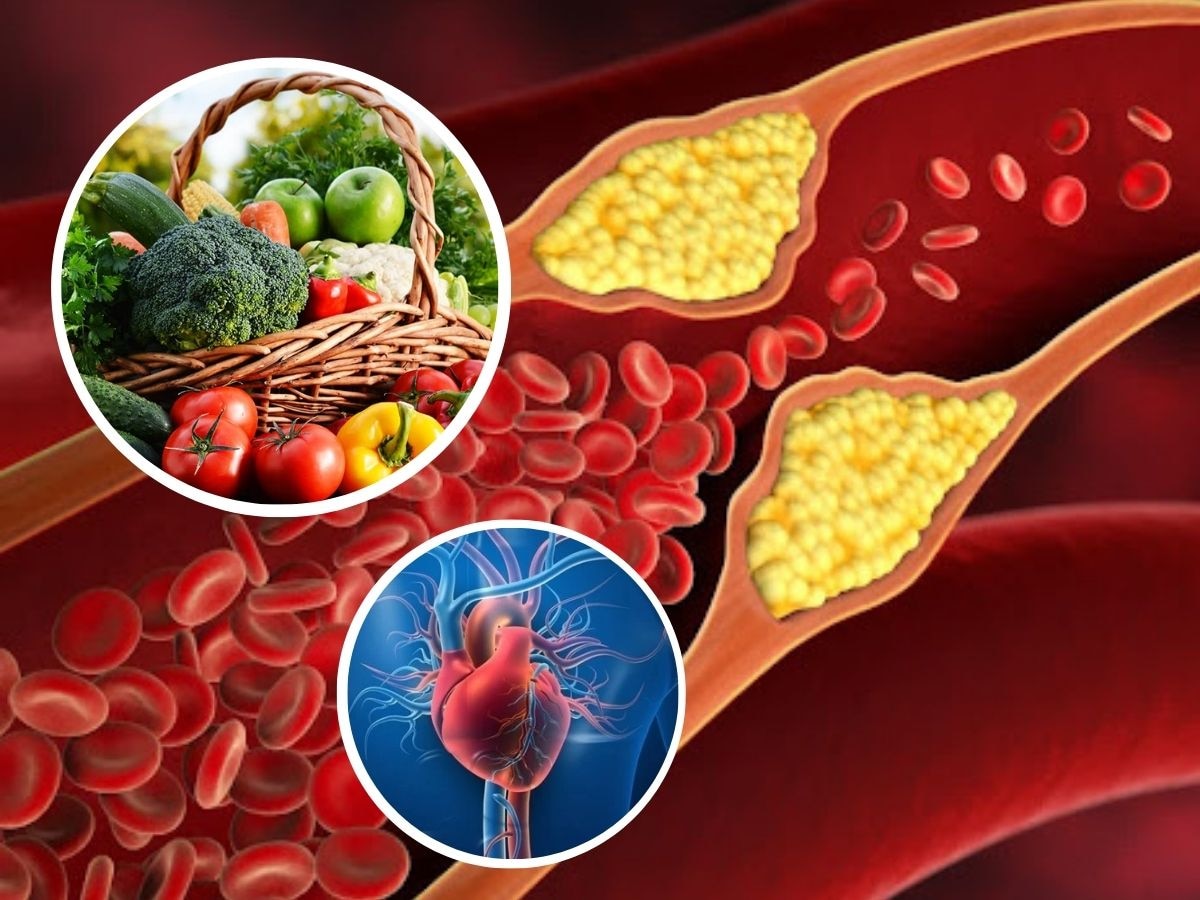 हाय कोलेस्ट्रॉलवर रामबाण ठरू शकतात 'या' 5 भाज्या, 15 दिवस सेवन केल्यास निघून जातील नसांमधील फॅट्स title=