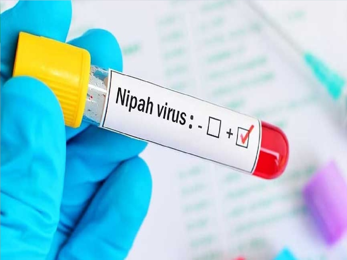 आधी मंकीपॉक्स आता Nipah Virus चा धोका, देशात 24 वर्षांच्या तरुणाचा मृत्यू... , वेळीच ही लक्षणं ओळखा? title=