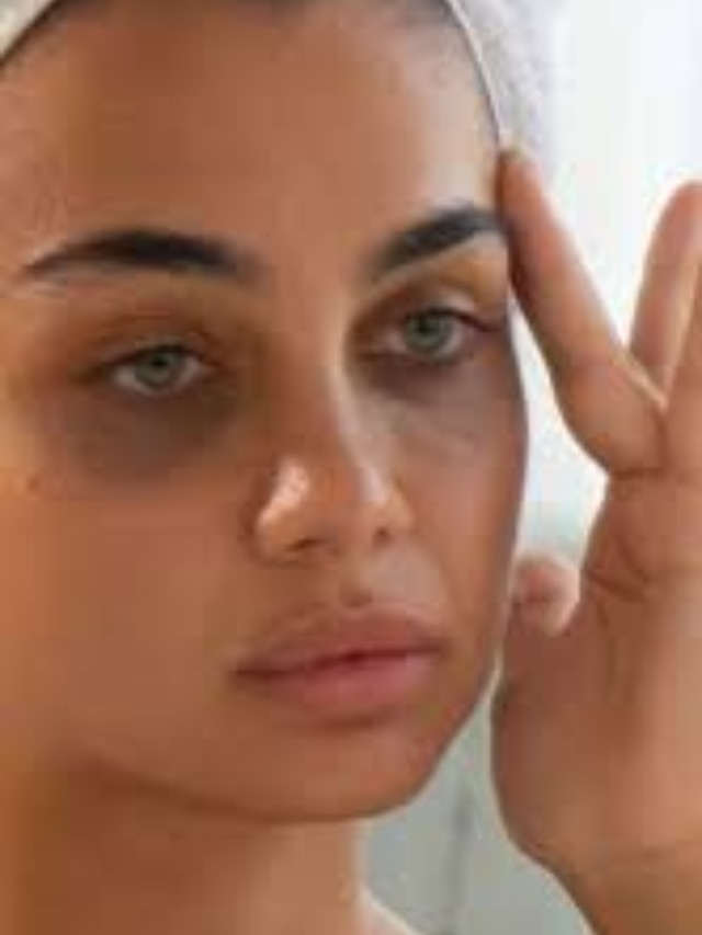 what are the homemade remedy for dark circles know skin care