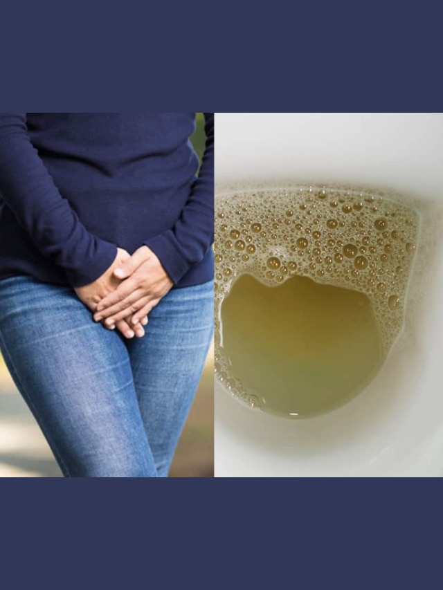 foam in your urine A symptom kidney Failure Diabetes dehydration Health Marathi News 