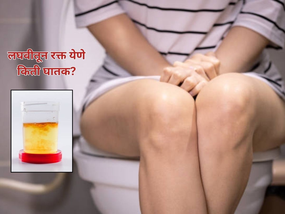 Blood in Urine : लघवीमधून रक्त येणे किती धोकादायक? जीवघेण्या आजारांचे देतात संकेत  title=