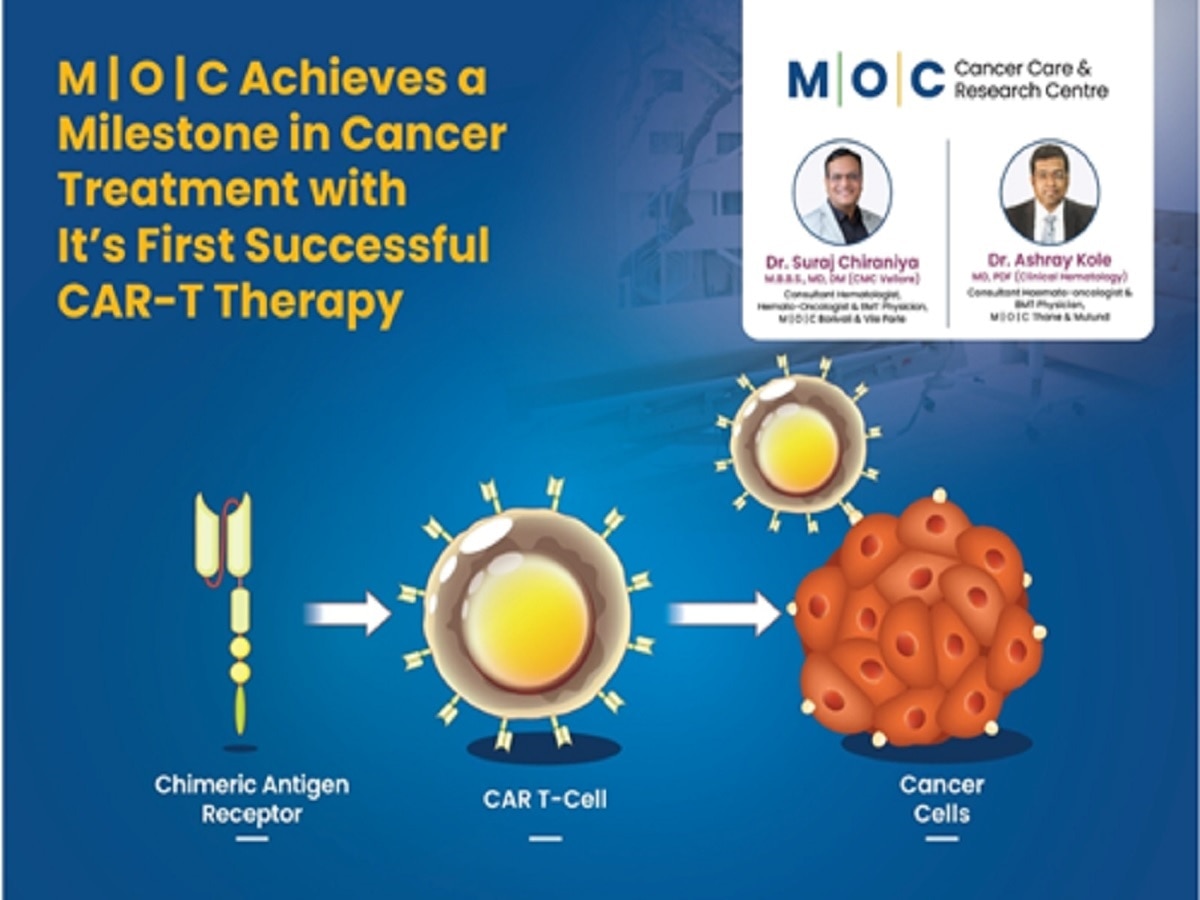 M | O | C कॅन्सर केअर आणि रिसर्च सेंटरने कॅन्सर उपचारात गाठला नवा मैलाचा दगड, पहिल्या यशस्वी CAR-T थेरपीची उपलब्धी title=