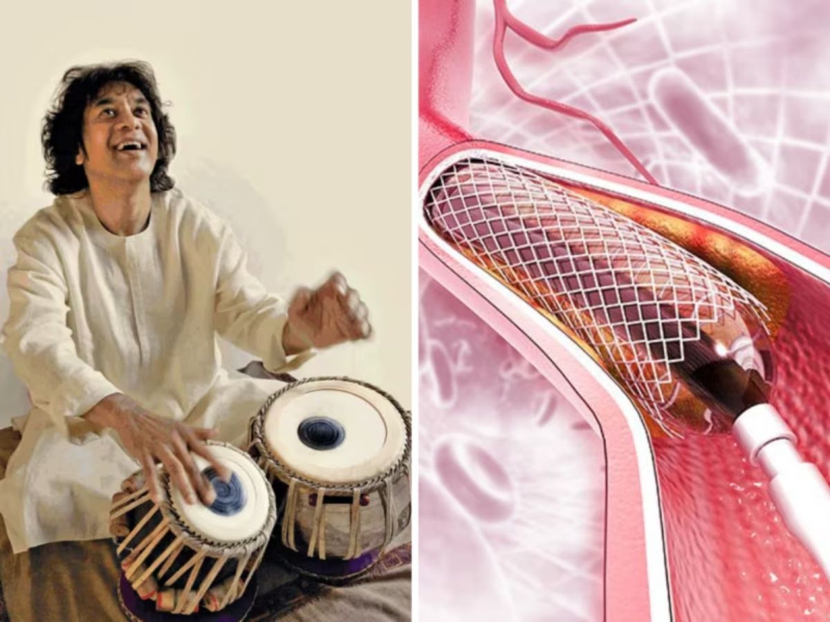 Zakir Hussain: हृदयात लावले होते 'स्टेंट', 'या' जीवघेण्या आजाराशी झुंज देत होते झाकिर हुसेन title=