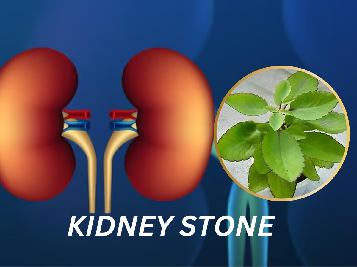 किडनी स्टोनचा त्रास 'या' वनस्पतीच्या दोन पानांद्वारे होईल दुर; आत्ताच या उपचाराविषयी जाणून घ्या  title=