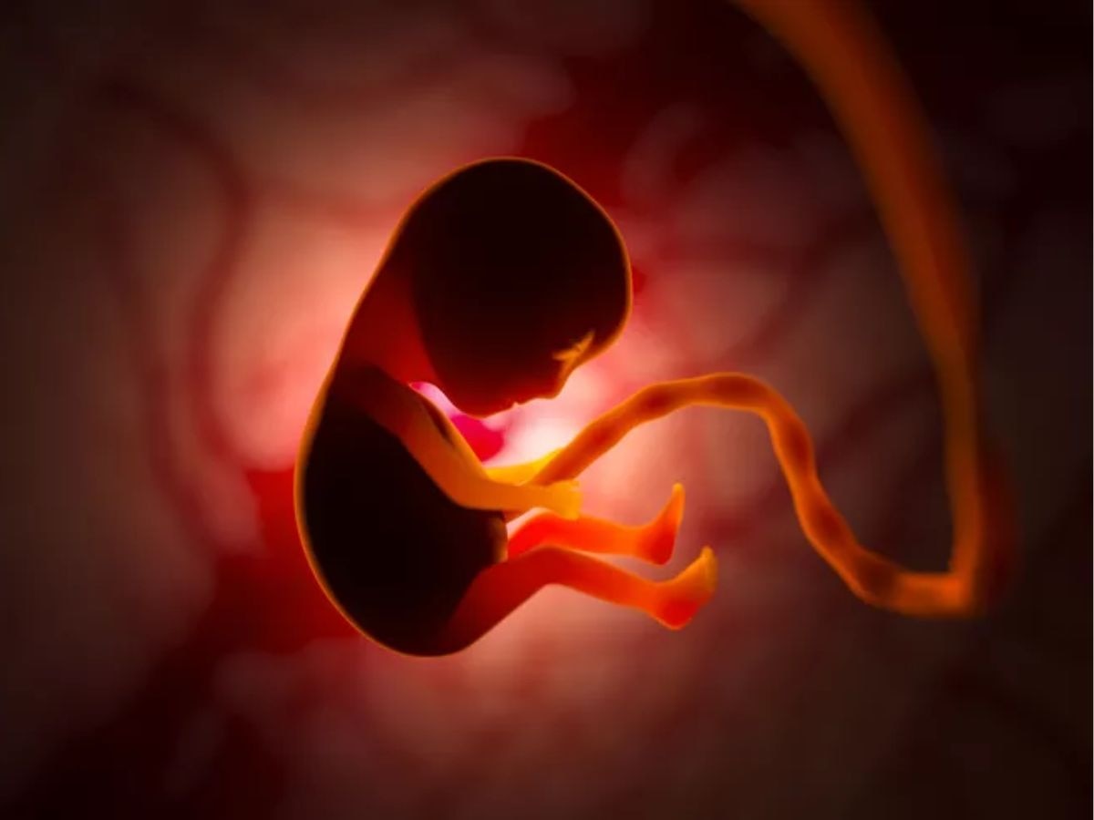 Fetus in Fetu : पोटात गर्भ घेऊनच जन्माला आलं मुलं; आज होणार शस्त्रक्रिया, राज्यातील पहिली घटना  title=