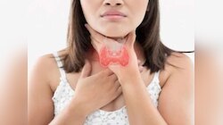 Thyroid Care: 'या' लक्षणांकडे अजिबात दुर्लक्ष करू नका, असू शकतो थायरॉईड