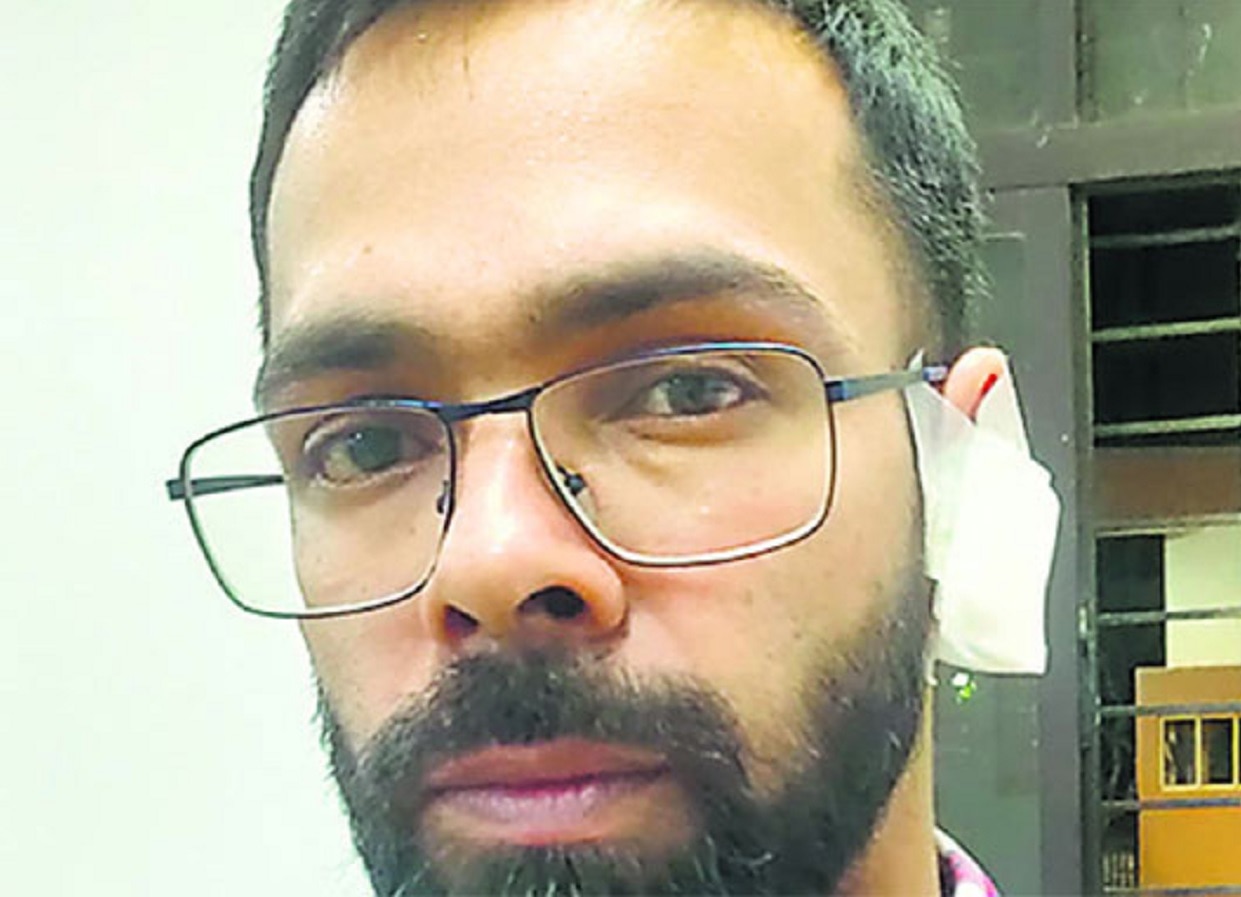 भांडणात तरुणाने मित्राचा कान चावून चक्क गिळला, ठाण्यातील धक्कादायक घटना