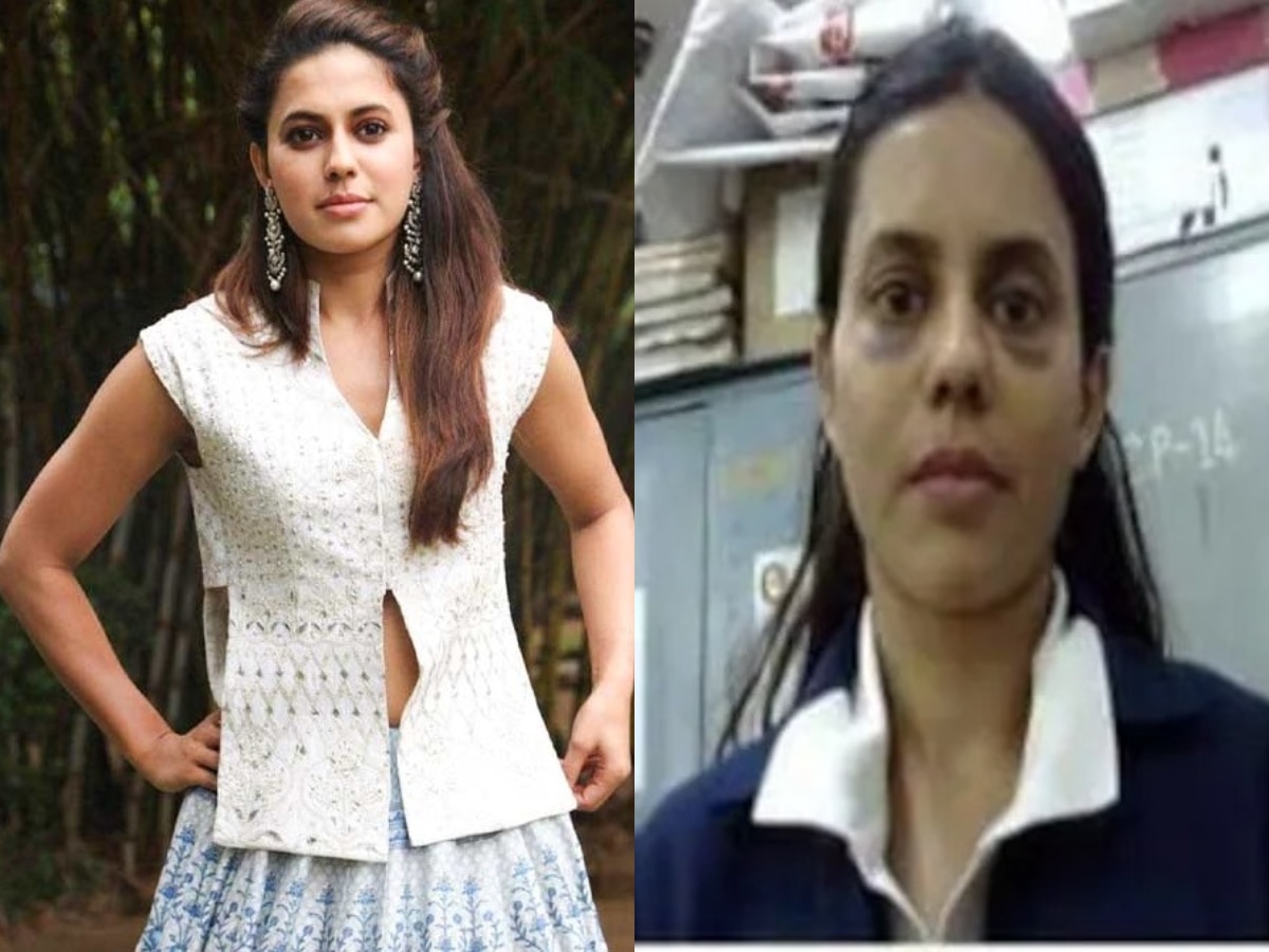 Viral Photo of Ranya Rao swollen eyes and bruises have triggered ...