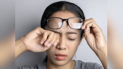 उन्हाची काहिली वाढली, डोळ्यांची काळजी घ्या; डॉक्टरांनी सांगितली लक्षणे आणि उपाय