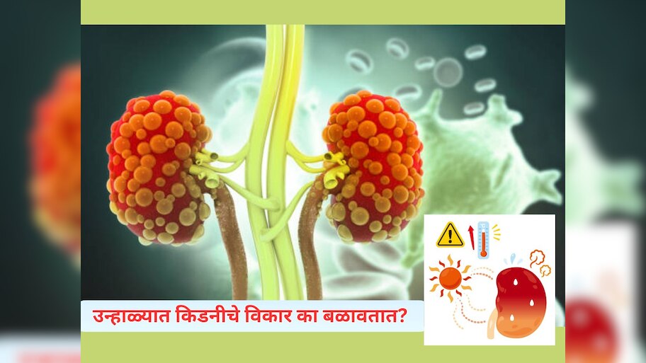 Kidney Health : उन्हाळ्यात केल्या जाणाऱ्या 5 कामांमुळे खराब होते किडनी; 99% लोकांना याची माहितीच नाही 