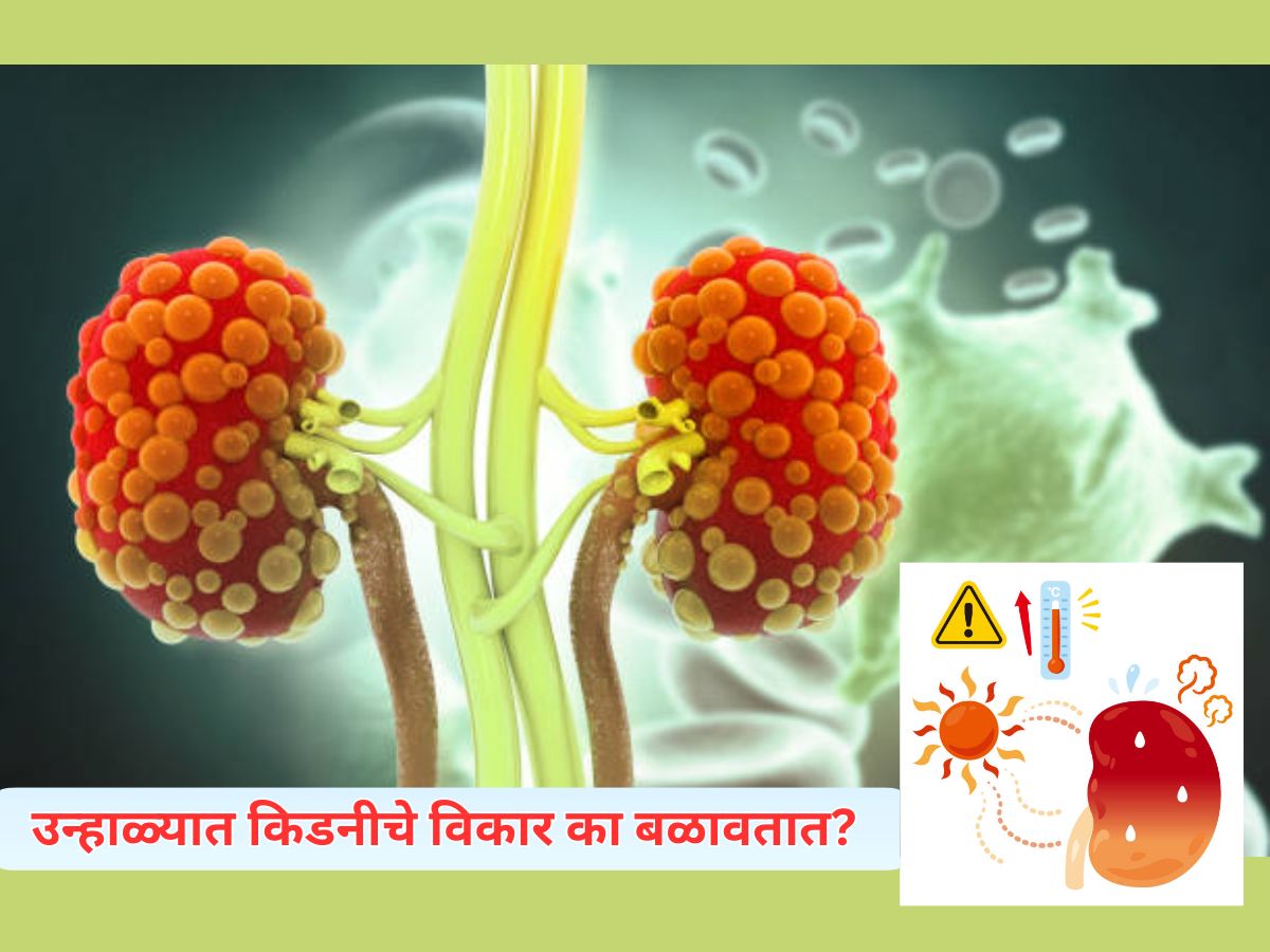 Kidney Health : उन्हाळ्यात केल्या जाणाऱ्या 5 कामांमुळे खराब होते किडनी; 99% लोकांना याची माहितीच नाही Kidney Health : उन्हाळ्यात केल्या जाणाऱ्या 5 कामांमुळे खराब होते किडनी; 99% लोकांना याची माहितीच नाही