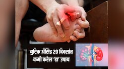 Uric Acid ने त्रासले आहात, आजपासूनच सुरु करा 3 कामे; 20 दिवसात दिसेल जबरदस्त फरक