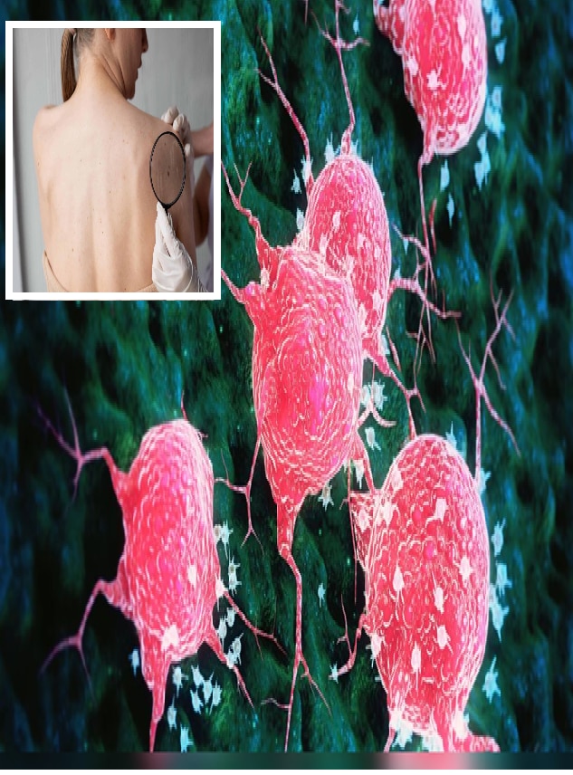 Cancer पसरल्यावर शरीरात काय लक्षणं दिसतात?