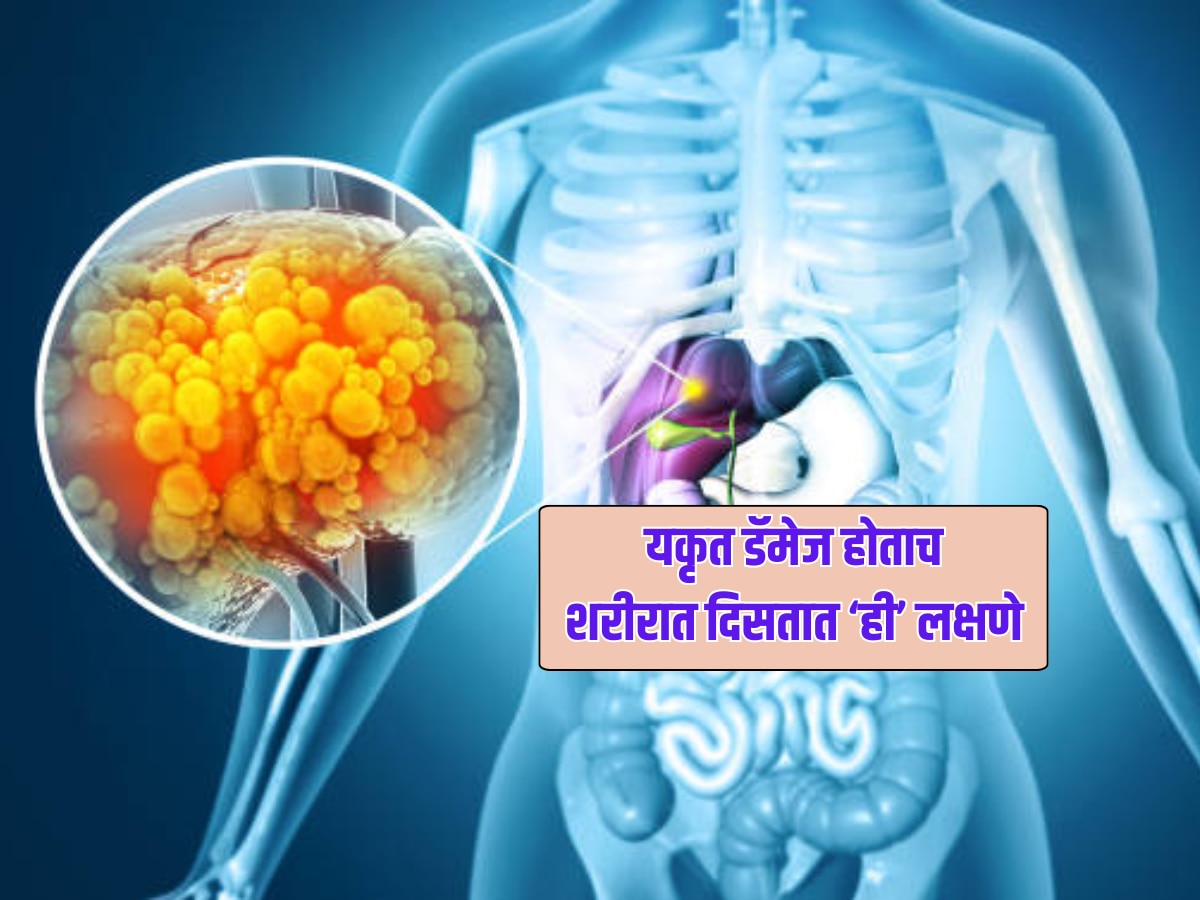 रात्री दिसतात लिवर डॅमेजची 5 लक्षणे, आताच व्हा सावधान, नाहीतर जीवावर बेतू शकतं 