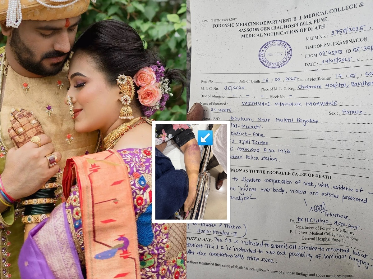 Vaishnavi Hagawane Death Case: वैष्णवी हगवणेचा पोस्टमॉर्टम रिपोर्ट अखेर आला समोर; धक्कादायक माहिती उघड Vaishnavi Hagawane Death Case: वैष्णवी हगवणेचा पोस्टमॉर्टम रिपोर्ट अखेर आला समोर; धक्कादायक माहिती उघड
