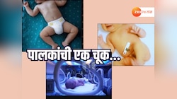 पालकांची एक चूक अन् नवजात बाळ थेट NICU मध्ये दाखल; डॉक्टरांनी सांगितलं,'डायपर घालताना नेमकं काय चुकलं?'