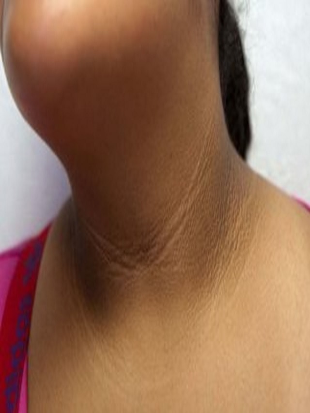 मानेच्या मागे साचलेला मळ 10 मिनिटांत होईल दूर, असा करा स्वच्छ 