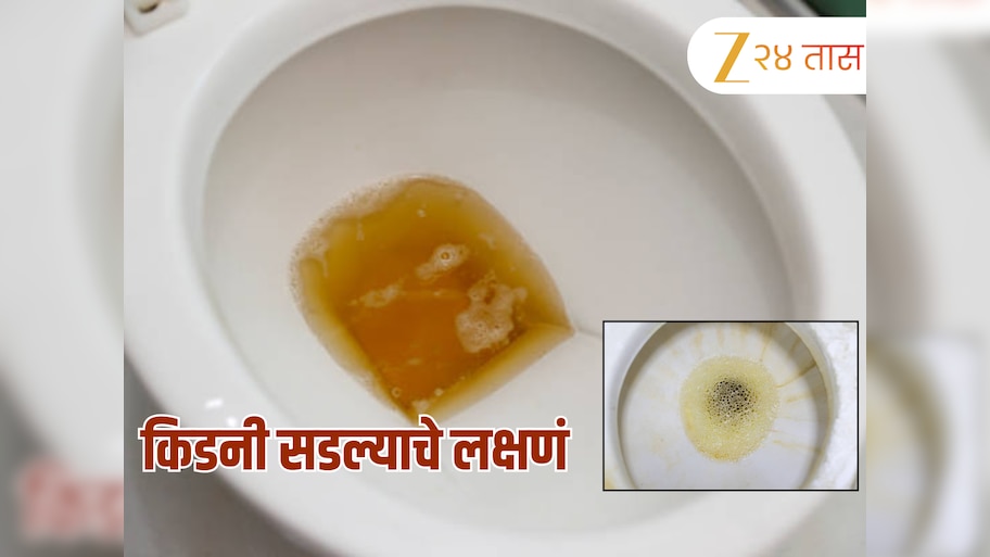 Foamy urine cause: लघवीदरम्यान येणारा फेस कोणत्या आजाराचं लक्षणं? आताच व्हा अलर्ट 