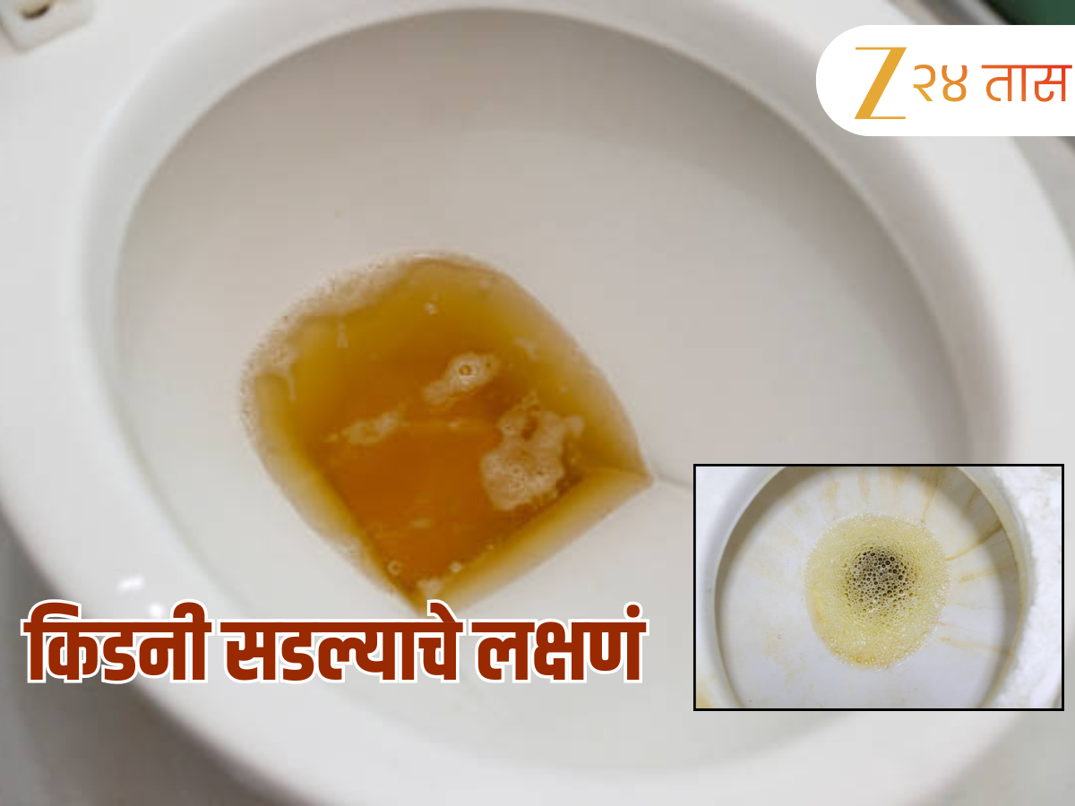 Foamy urine cause: लघवीदरम्यान येणारा फेस कोणत्या आजाराचं लक्षणं? आताच व्हा अलर्ट Foamy urine cause: लघवीदरम्यान येणारा फेस कोणत्या आजाराचं लक्षणं? आताच व्हा अलर्ट