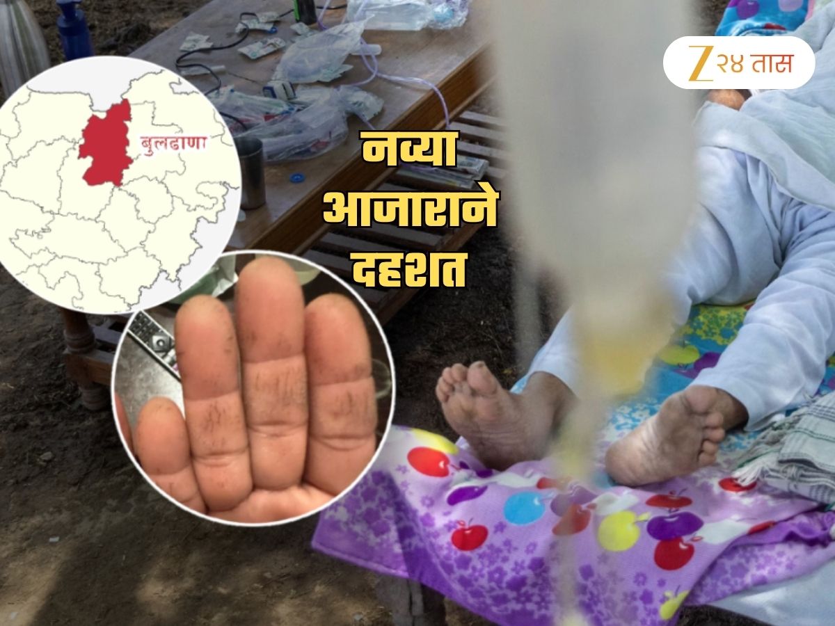 बुलढाण्यात पुन्हा रहस्यमय आजाराचं थैमान! हातांवर दिसतायेत लक्षणं; तातडीने डॉक्टरांचं विशेष पथक रवाना बुलढाण्यात पुन्हा रहस्यमय आजाराचं थैमान! हातांवर दिसतायेत लक्षणं; तातडीने डॉक्टरांचं विशेष पथक रवाना