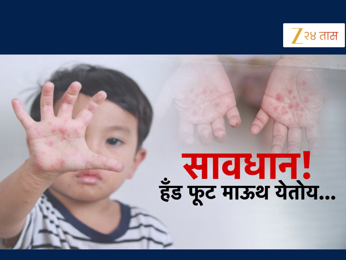 लहान मुलांमध्ये पसरतोय HFMD? काय आहेत ‘या’ आजाराची लक्षणे?