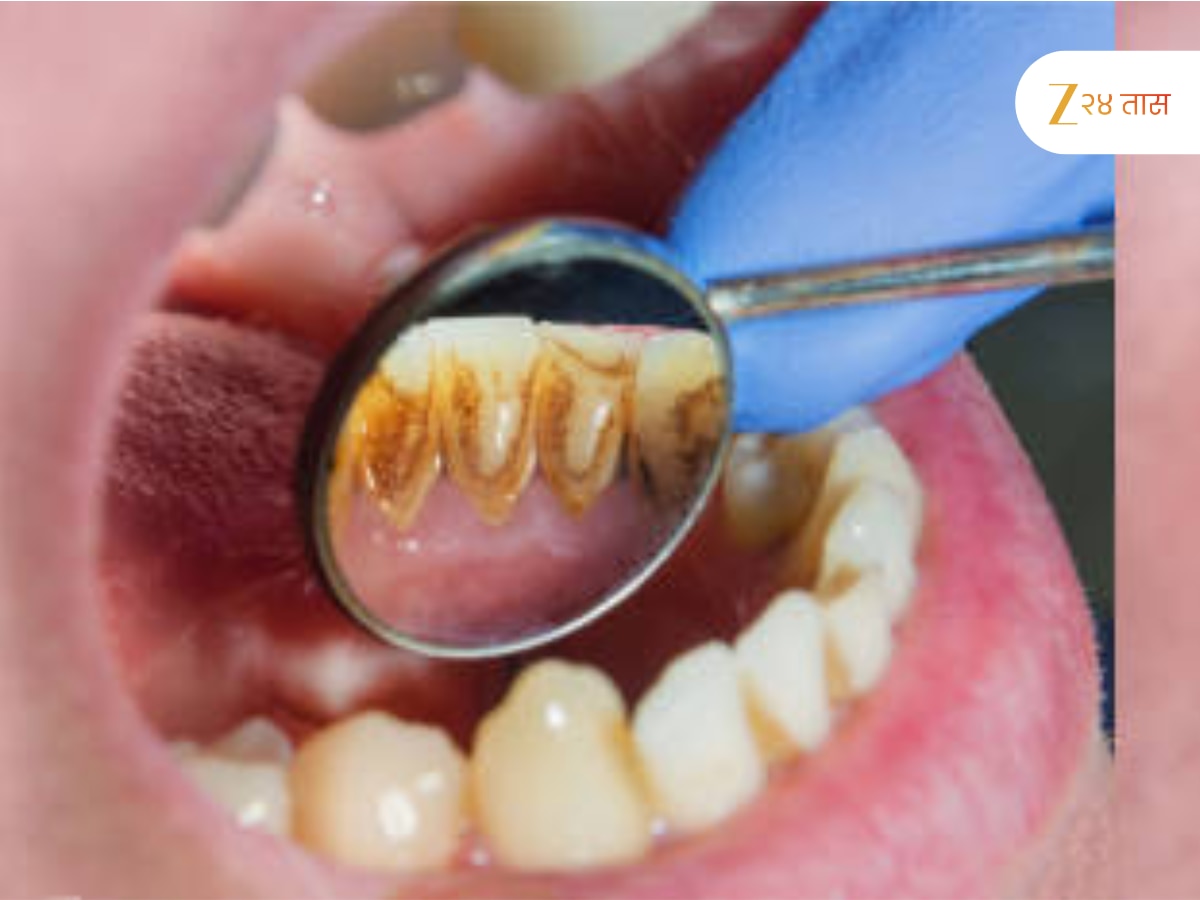 Oral Hygiene when you should not brush your teeth its affect badly ...