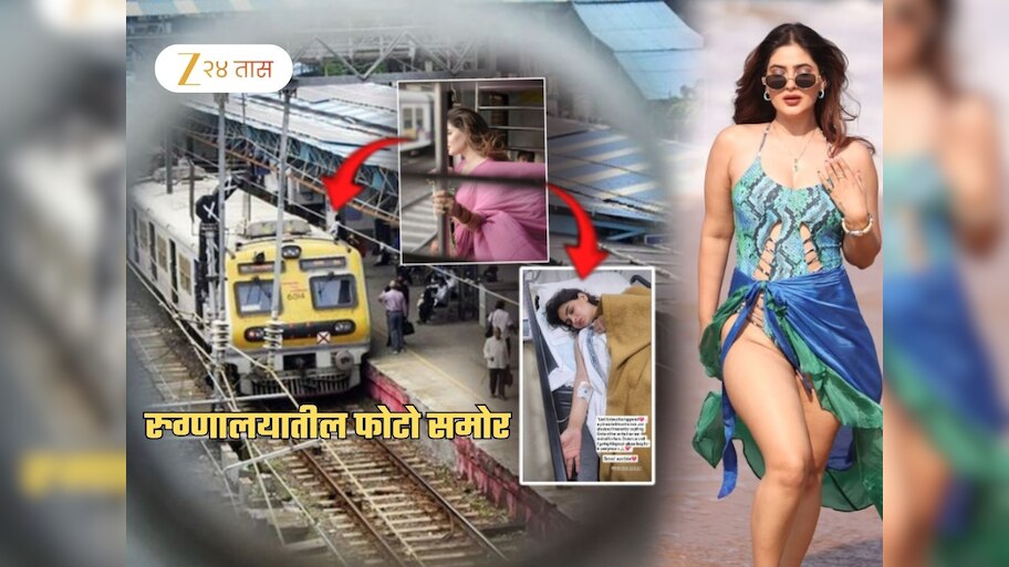 प्रसिद्ध अभिनेत्रीची धावत्या लोकल ट्रेनमधून उडी! गंभीर जखमी; रुग्णालायतील हादरवणारा फोटो समोर