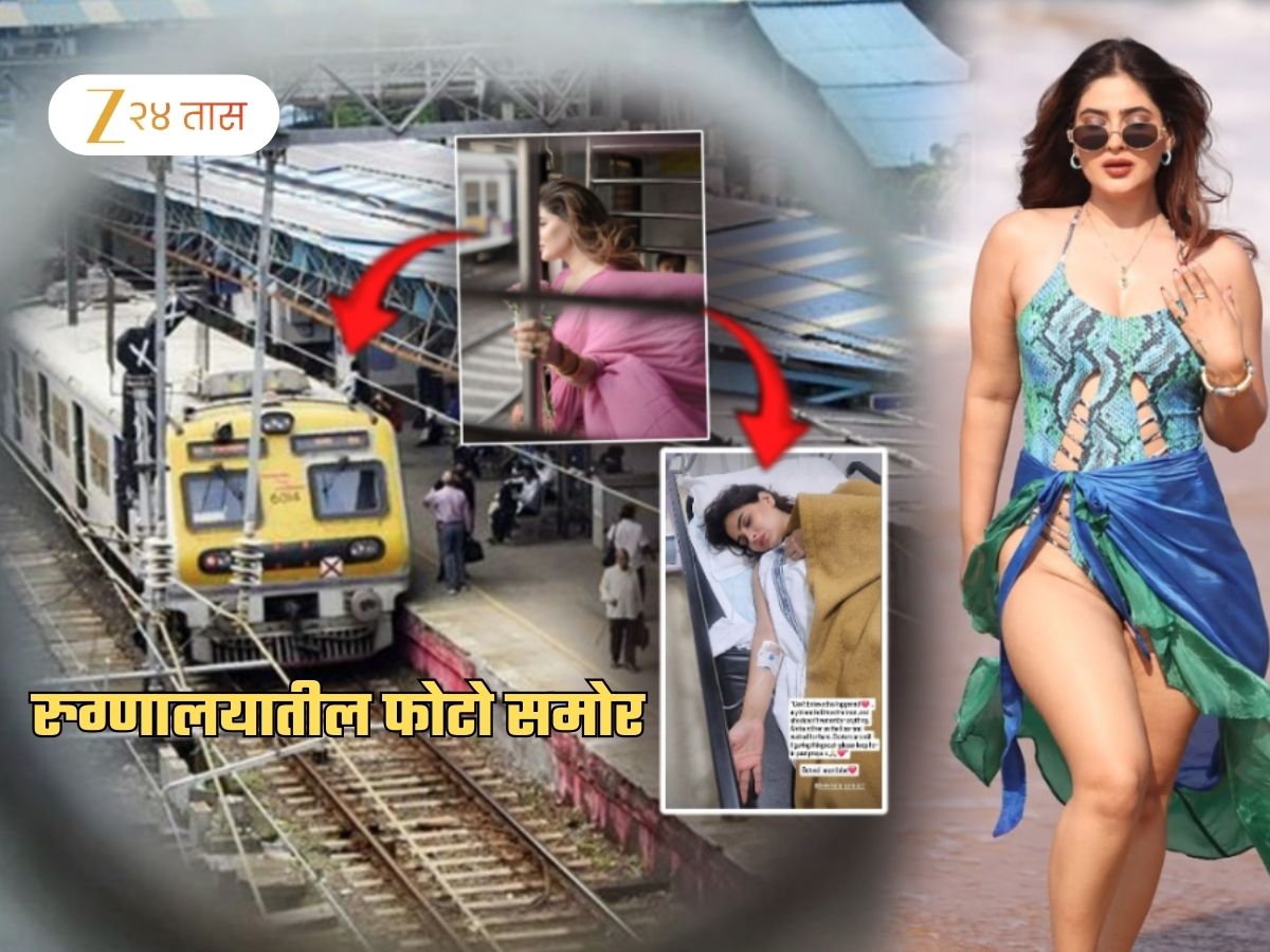 प्रसिद्ध अभिनेत्रीची धावत्या लोकल ट्रेनमधून उडी! गंभीर जखमी; रुग्णालायतील हादरवणारा फोटो समोर प्रसिद्ध अभिनेत्रीची धावत्या लोकल ट्रेनमधून उडी! गंभीर जखमी; रुग्णालायतील हादरवणारा फोटो समोर