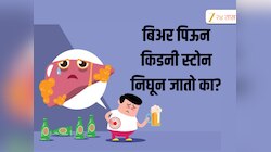 बिअर पिऊन किडनीमधील मुतखडा बाहेर पडतो का? डॉक्टरांनी सांगितलं 'हे' करणं योग्य आहे का? 