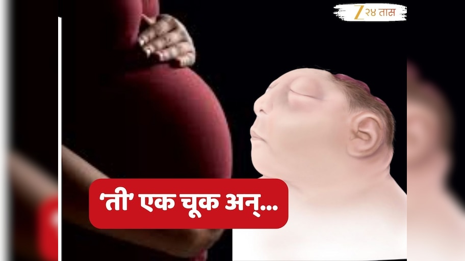 गर्भावस्थेत कुटुंबाच्या 'त्या' चुकीमुळे जन्माला आलं विना डोक्याचं बाळ; आईच्या पायाखालची जमीन सरकली