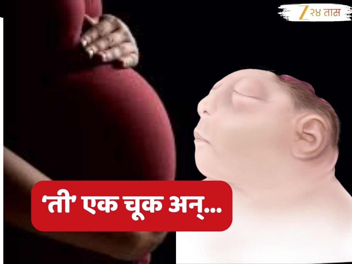 गर्भावस्थेत कुटुंबाच्या 'त्या' चुकीमुळे जन्माला आलं विना डोक्याचं बाळ; आईच्या पायाखालची जमीन सरकली गर्भावस्थेत कुटुंबाच्या 'त्या' चुकीमुळे जन्माला आलं विना डोक्याचं बाळ; आईच्या पायाखालची जमीन सरकली