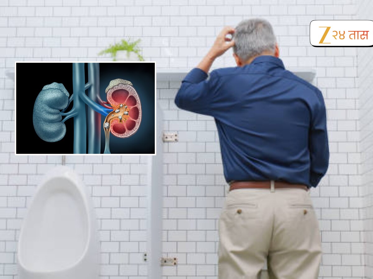थांबून थांबून लघवीला होते? किडनी खराब तर झाली नाही ना? डॉक्टरांनी केला धक्कादायक खुलासा...