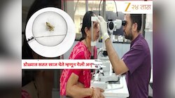 Video: धक्कादायक! वृद्धेच्या पापण्यांतून निघाल्या 250 उवा अन् 80 अंडी; गुजरातमधील घटना 