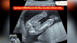 चाललंय काय? महाराष्ट्रात गर्भलिंगनिदानाचं मोठं रॅकेट उघड; मध्य प्रदेश कनेक्शन समोर..