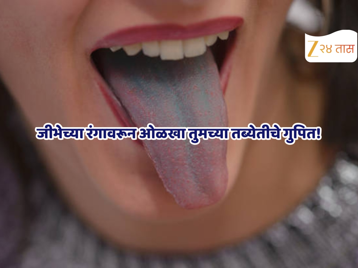 जीभ काळी नाही पण पांढरी अन् पिवळी आहे का? रंगावरुन ओळखा आरोग्याची स्थिती?
