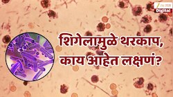 काय आहे शिगेला? ज्यामुळे लोकांचा उडेल थरकाप, केरळमध्ये धडाधड बंद होतायत रेस्टॉरंट; लक्षण एकदा जाणून घ्या?