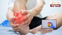 शरीरातील युरिक ऍसिड झपाट्याने वाढवतात 5 पदार्थ, कसं कराल कंट्रोल? 