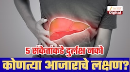 तळहात लाल, नखांचा रंग बदलणं ही कोणत्या गंभीर आजाराची लक्षणे? 5 संकेतांकडे अजिबात करु नका दुर्लक्ष!